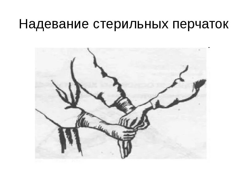 Алгоритм надевания перчаток. Надевание стерильных перчаток. схема надевания стерильных перчаток. одевание стерильных перчаток. алгоритм надевания стерильных перчаток на хирурга.