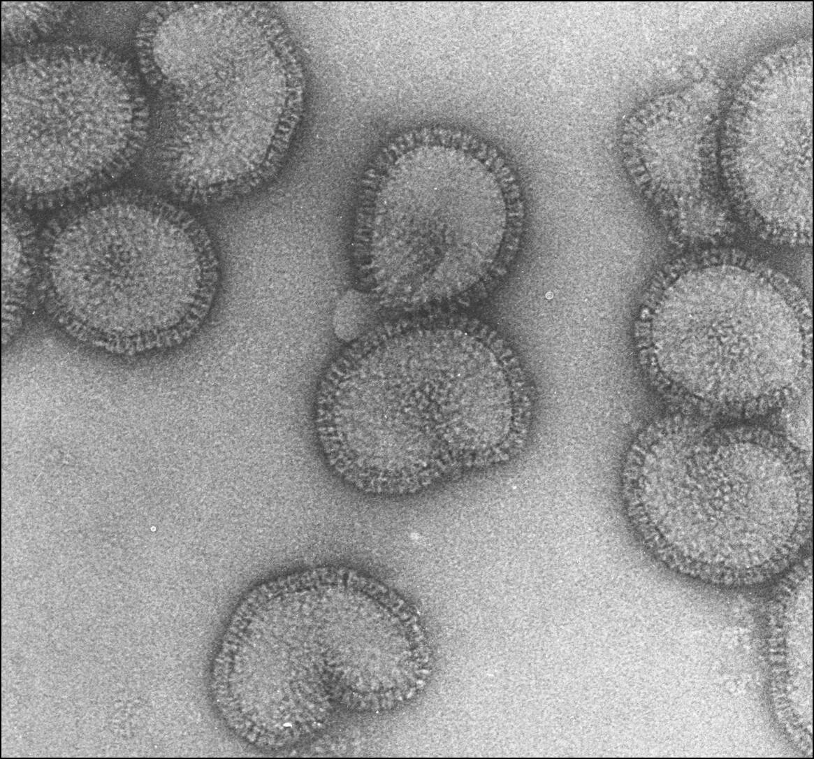 How Does the Flu Actually Kill People? Scientific American
