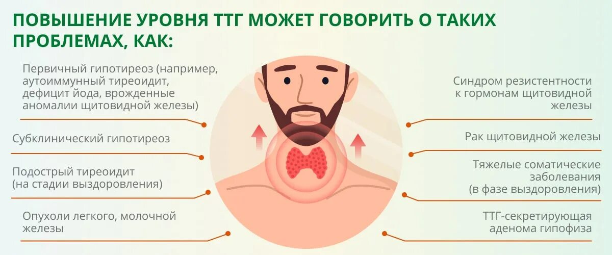 Перед ттг можно пить воду. Симптомы повышенного гормона ТТГ. Симптомы пониженного тиреотропного гормона. Повышение тиреотропного гормона причины. ТТГ TSH тиреотропный гормон повышен.