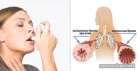 Как остановить сильный сухой кашель у ребенка в домашних условиях - чем снять пр