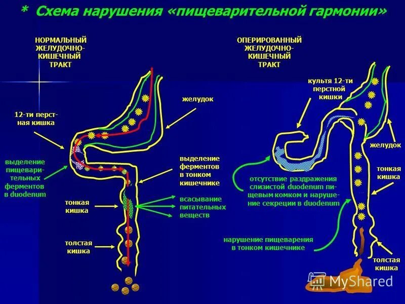 Ферменты 12 перстной. Пищеварение в 12 перстной кишки физиология. Фермент 12 ти перстной кишки. Сбой пищеварения схема. Роль 12 перстной кишки в пищеварении физиология.