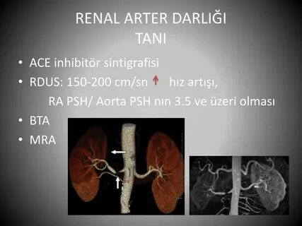 Renal почки