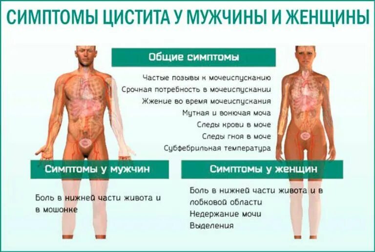 Цистит у мужчин симптомы. Цистит симптомы. Симптомы цистита у мужчин. Острый цистит симптомы у мужчин. Цистит у женщин и мужчин.
