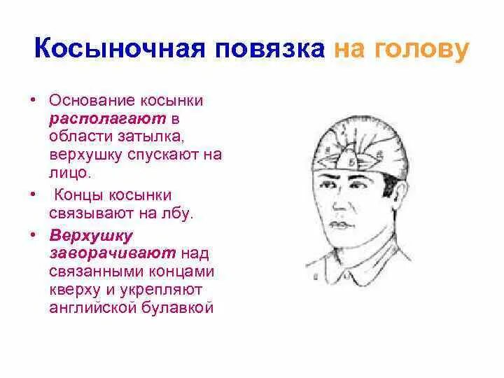 Повязка накладывается при повреждении затылка. Техника наложения косыночной повязки на голову. Алгоритм наложения косыночной повязки на голову. Как накладывается Косыночная повязка на голову?. Косыночка повязка на голову при травме.