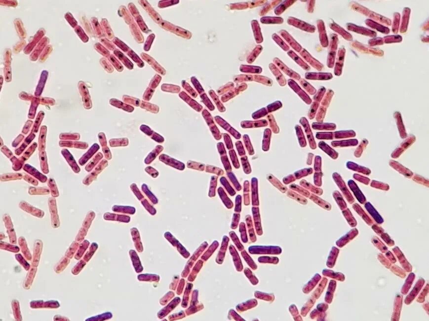 Escherichia coli под микроскопом. Кишечная палочка грамотрицательная. E coli микроскопия. Эшерихия коли микроскопия. Escherichia coli по граму.