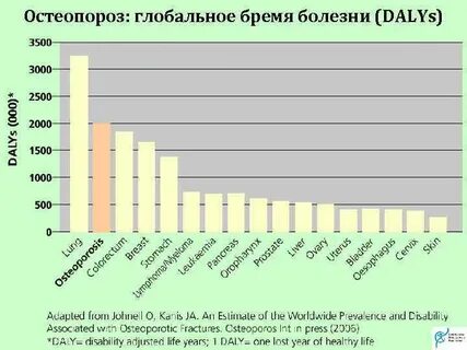 Остеопороз статистика