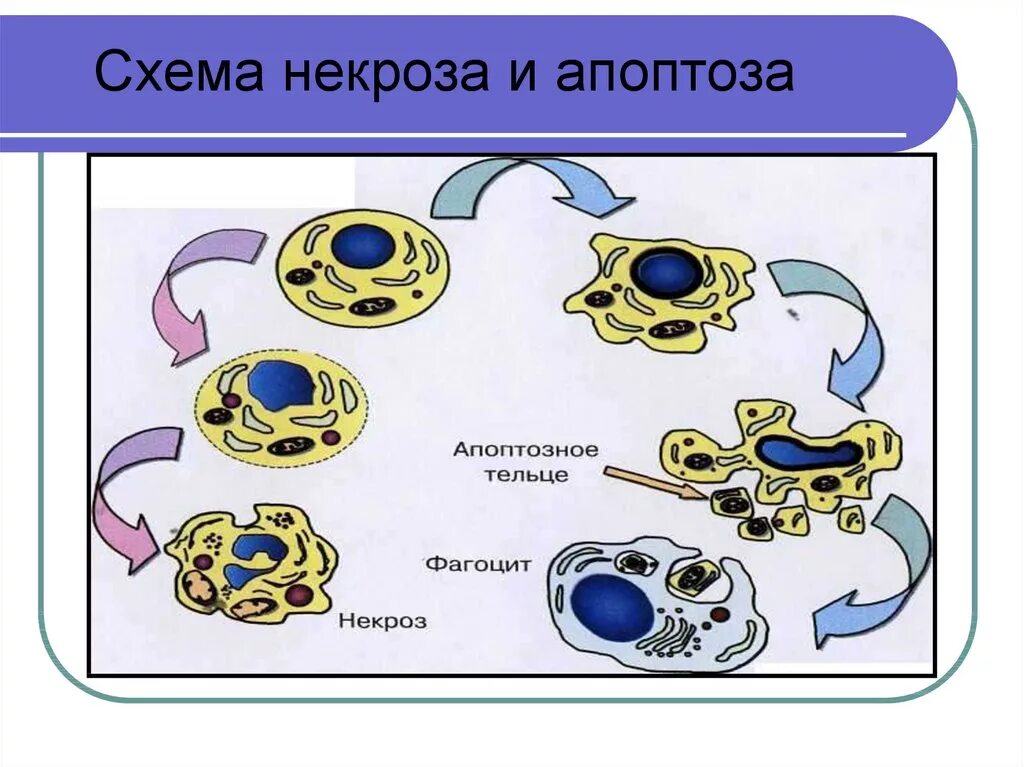 Некроз схема. Схема апоптоза. Апоптоз и некроз. Стадии апоптоза схема. Необратимые изменения клетки