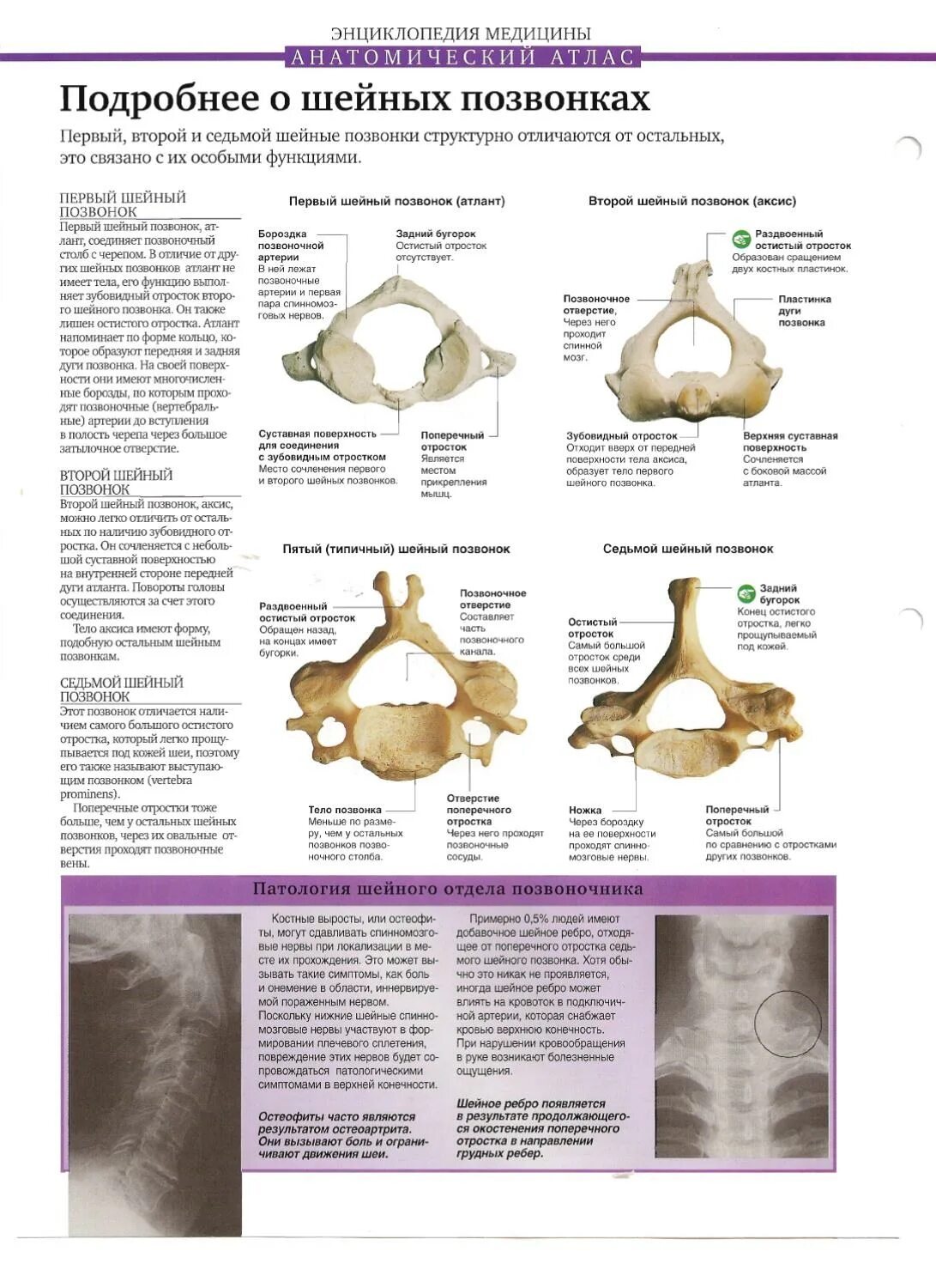 Шейный позвонок Атлант строение. 2 Шейный позвонок Атлант. Второй шейный позвонок - Axis и Atlas. Первый и второй шейные позвонки. Характерные признаки шейного позвонка
