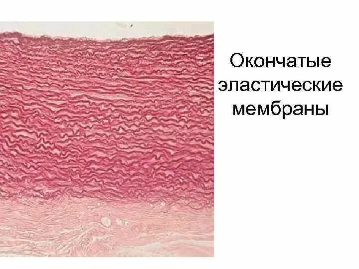 Артерия эластического типа препарат гистология. Артерия эластического типа аорта. эластические мембраны гистология. артерия эластического типа гистология.