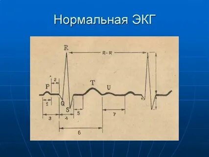 Нормальной форум