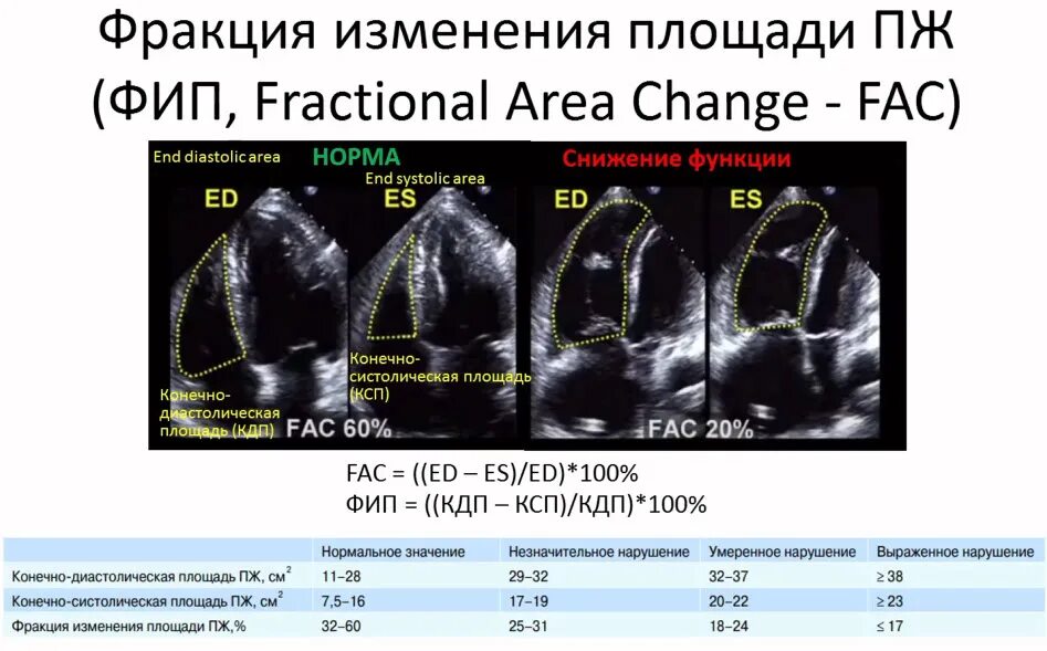 Диастолический размер левого желудочка норма. Нормальные параметры левого желудочка. Фракционное изменение площади правого желудочка. Толщина левого желудочка норма.