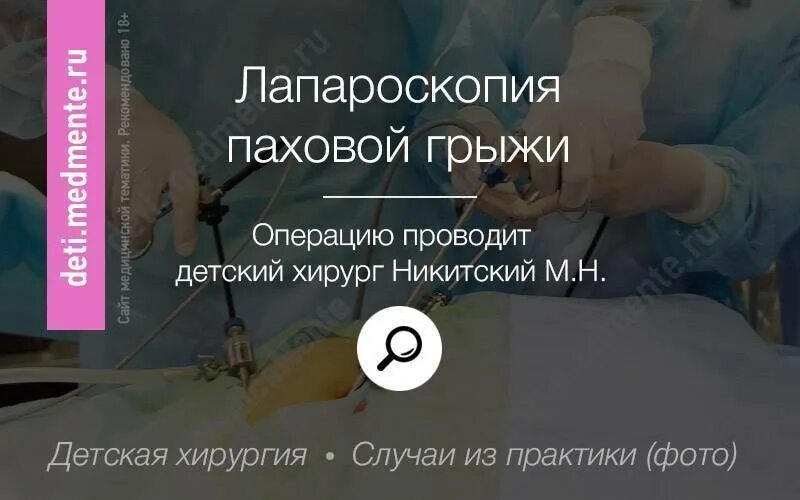 Анализы перед операцией грыжи. Лапароскопия паховой грыжи у детей. Лапароскопические операции паховая грыжа. Лапароскопическая хирургия грыжи паховой. Паховая грыжа удаление операция.