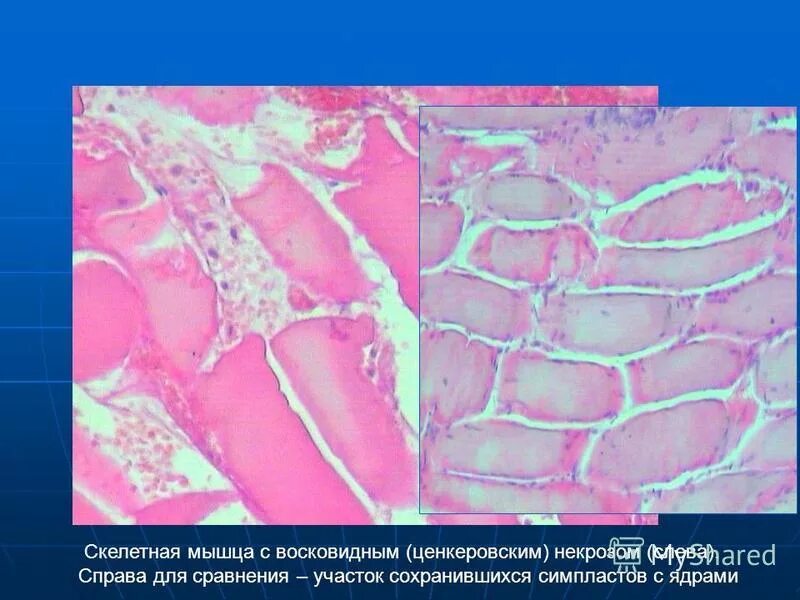 темы по патологической анатомии