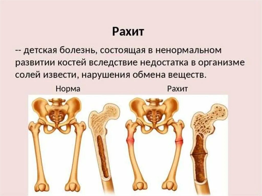 В костях и т д. Кости ребенка.