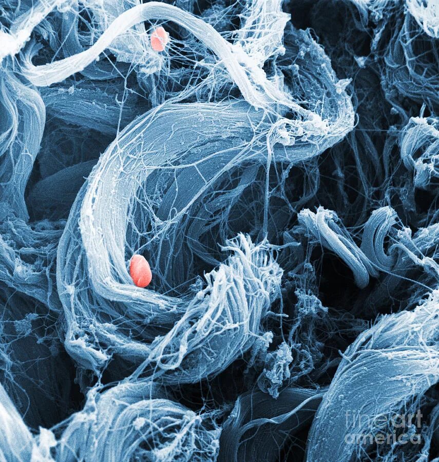 Микроскопические исследования волокон. Микроскопические исследования волокон. Волокно хлорин под микроскопом. Методы исследования. Микропрепарат волокна ваты.