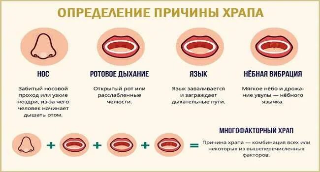 Почему люди храпят во сне. Храп новорожденного. Храп у ребенка 2 года во сне. Храп механизм возникновения. Причины храпа у ребенка 2 года.
