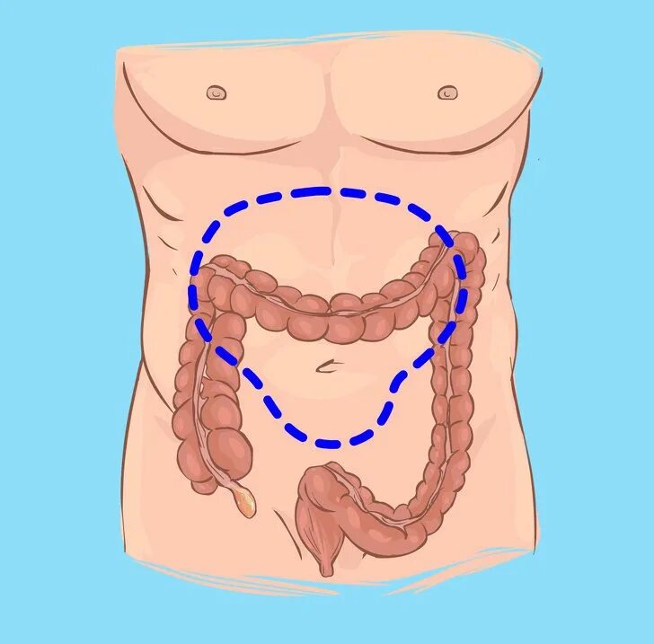 С какой стороны живота находится аппендицит. Червеобразный отросток толстой кишки.