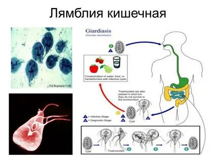 Лямблия стадии