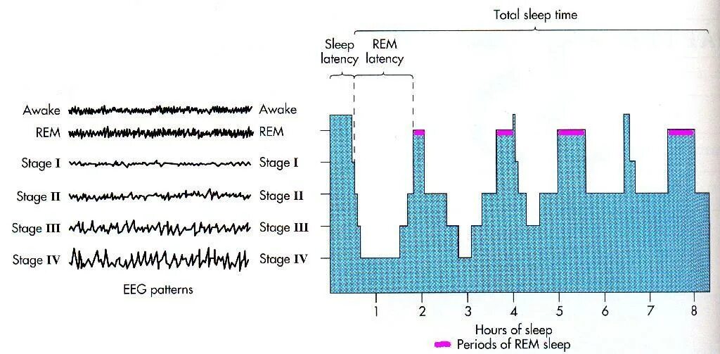 Rem фаза сна. Структура сна график. Фазы сна Rem deepjhvfntr. Что значит Rem фаза сна.