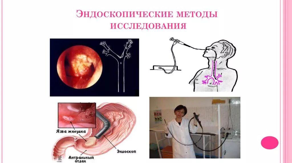 Эндоскопические осложнения. Эндоскопические методы исследования. Эндоскопическимметоды исследования». Методы эндоскопические методы. Эндоскопический метод исследования.