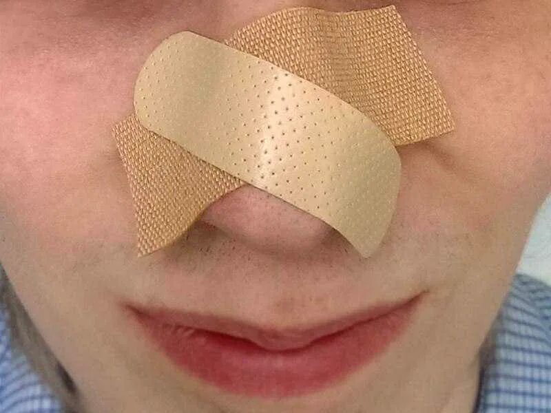 Пластырь на щеке. Пластырь на подбородке. Лейкопластырь на лбу. Пластырь на щеке. Лейкопластырь на лбу.