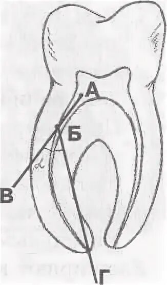 Строение корня зуба человека. Началось судоходство по ладожскому каналу. Устья пульповой камеры. Структура ионного канала. - ладожский канал императора петра великого.