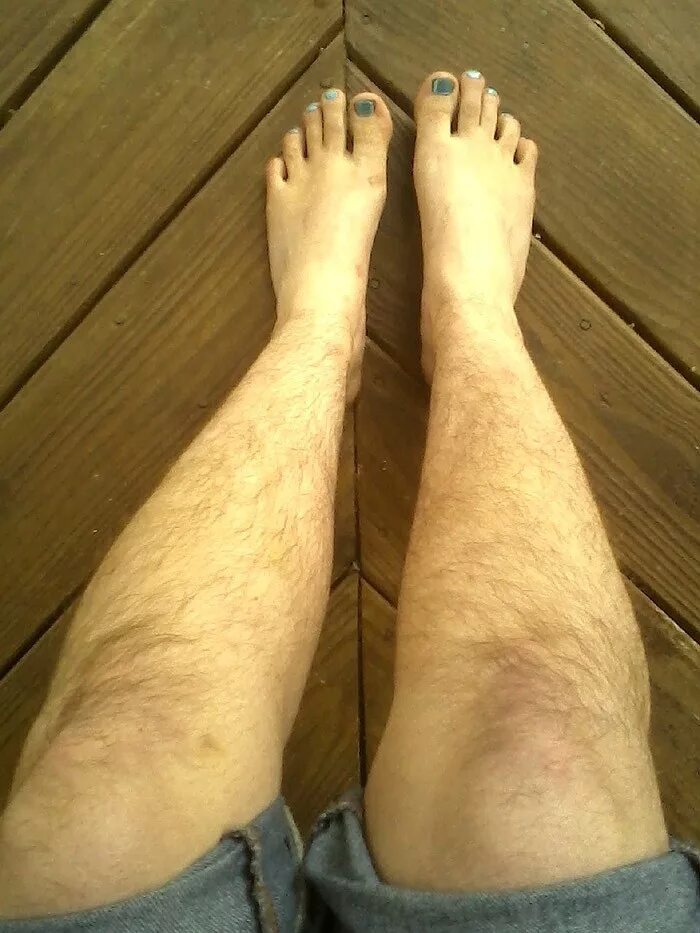 Волосатые женскиетноги. Ножки мужские. Женские волосяные ноги. Very hairy legs