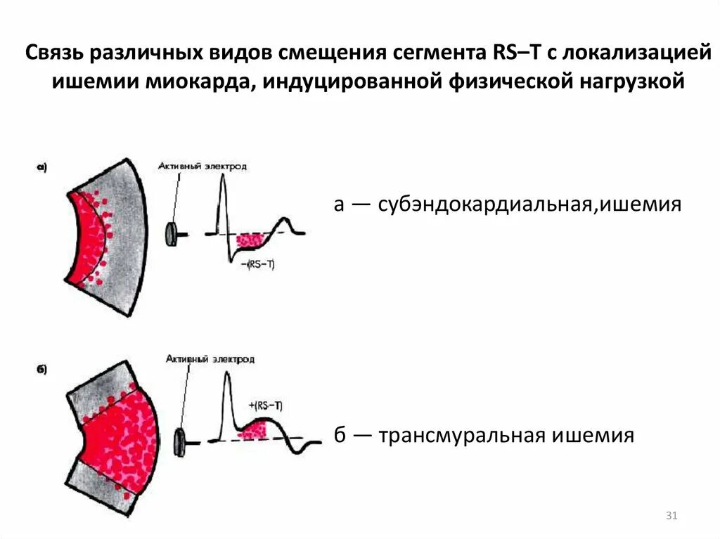 Потенциал смещения. Потенциал смещения