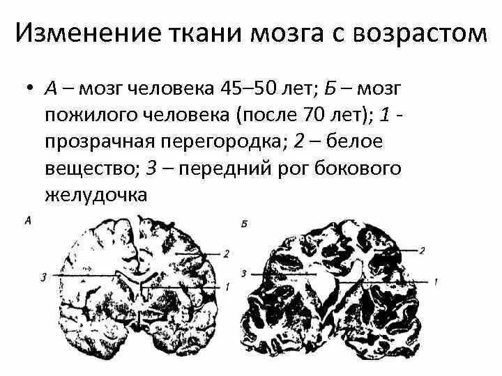 Вызвать изменения мозгу изменения. Изменение мозга с возрастом. Структурные изменения головного мозга. Возрастные головного мозга.. Изменение человеческого мозга с возрастом.