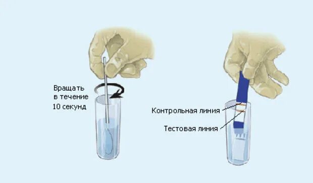 Как отличить околоплодные. Как выглядит подтекание околоплодных вод. Тест на подтекание мочи. Тест на околоплодные воды. Мазок на подтекание околоплодных вод.