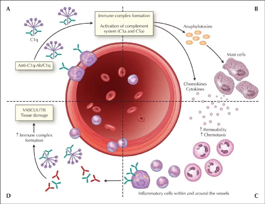 Васкулит патогенез. Геморрагические диатезы васкулит. Системные васкулиты этиология. Системные васкулиты патогенез.