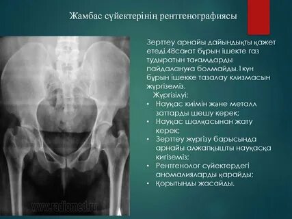 Skyrim порно пародиялары