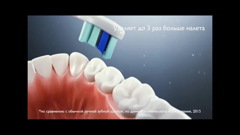 Правильно чистить зубы электрической щеткой видео. Правильно чистить зубы электрической щеткой видео