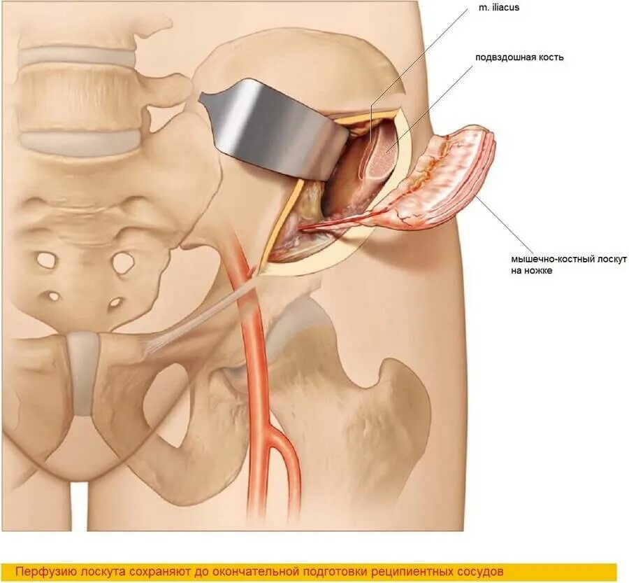 Ость гребня подвздошной кости. Тазовая кость анатомия человека. Скелет тазобедренный сустав анатомия. Женский таз тазовая кость. Тазовые кости человека анатомия.