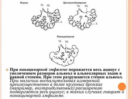 Аускультация при эмфиземе