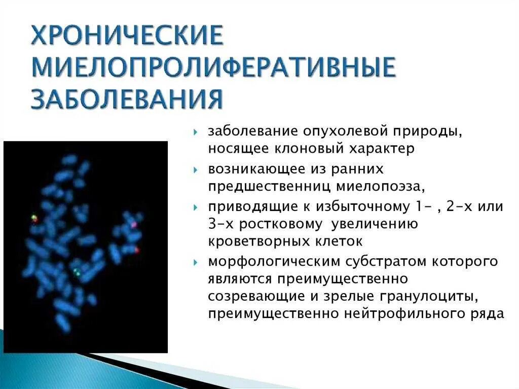 Заболевание переходит в хроническую. Хроническое миелопролиферативное заболевание. классификация миелопролиферативных заболеваний. миелопролиферативного заболевания что это.