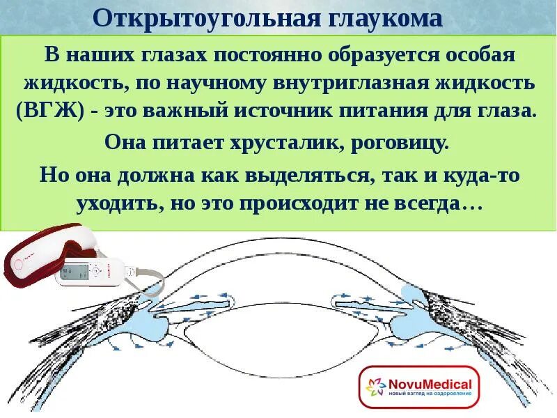 Открытоугольная глаукома презентация. Внутриглазная жидкость образуется. Внутриглазная жидкость питает. Открытоугольная глаукома опасна течением.