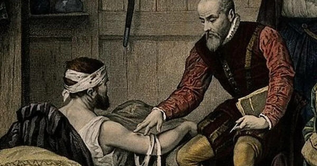 Французский хирург Амбруаз паре (1510—1590). Амбруаз паре труды. Амбруаз паре Трепанация черепа. Хирург Амбруаз паре. Возрождение доктора