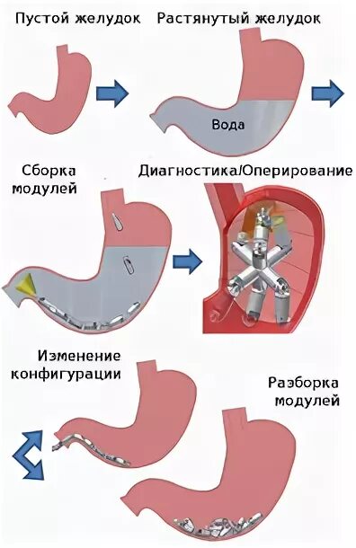 Вода в желудке задерживается. Объем растянутого желудка. Почему вода в желудке