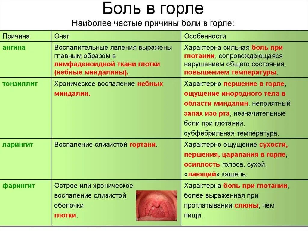 Локализация боли в горле. Кашель и боль в горле у ребенка. Болит горло у взрослого лечение