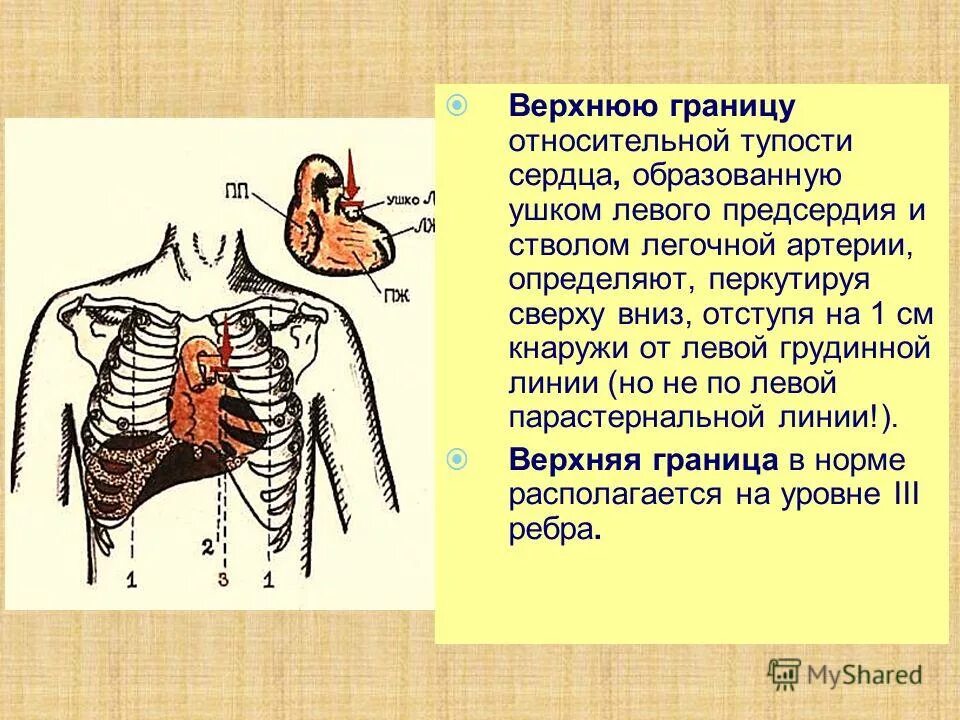 верхняя граница сержуп. сердце границы сердца. верхняя граница сердца расположена. границы сердца топографическая анатомия. границы сердца в норме.
