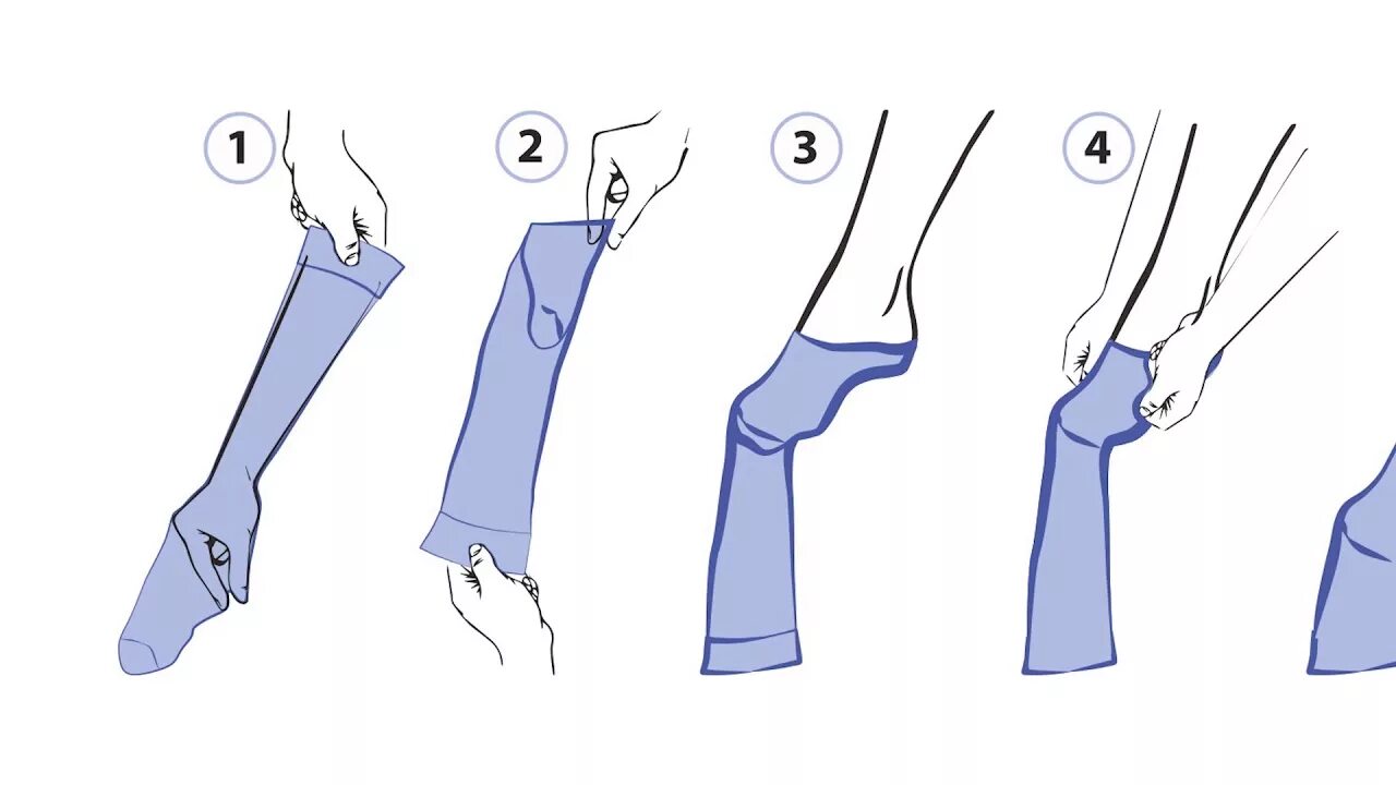 Как правильно надевать чулки перед операцией. Как надеть компрессионные чулки 1 класса. Как правильно одевать компрессионные чулки. Чулки компрессионные 2 как правильно надевать. Как правильно одеть компрессионные чулки в домашних условиях.