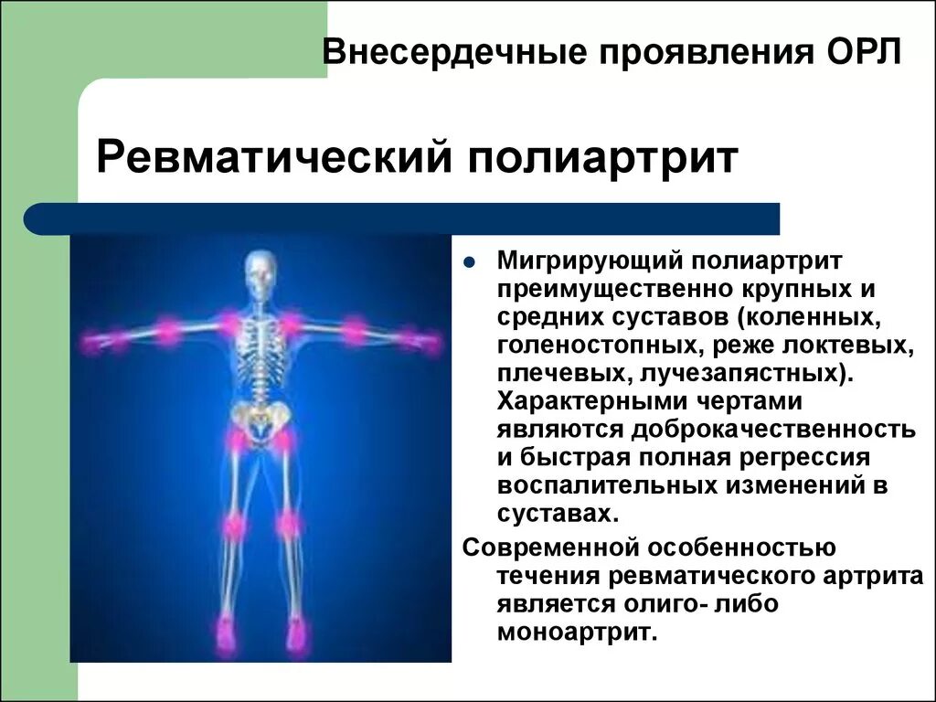 Ревматоидный артрит лихорадка. Ревматоидный полиартрит. ревматический полиартрит. ревматический полиартрит поражение суставов. поражение суставов при острой ревматической лихорадке.