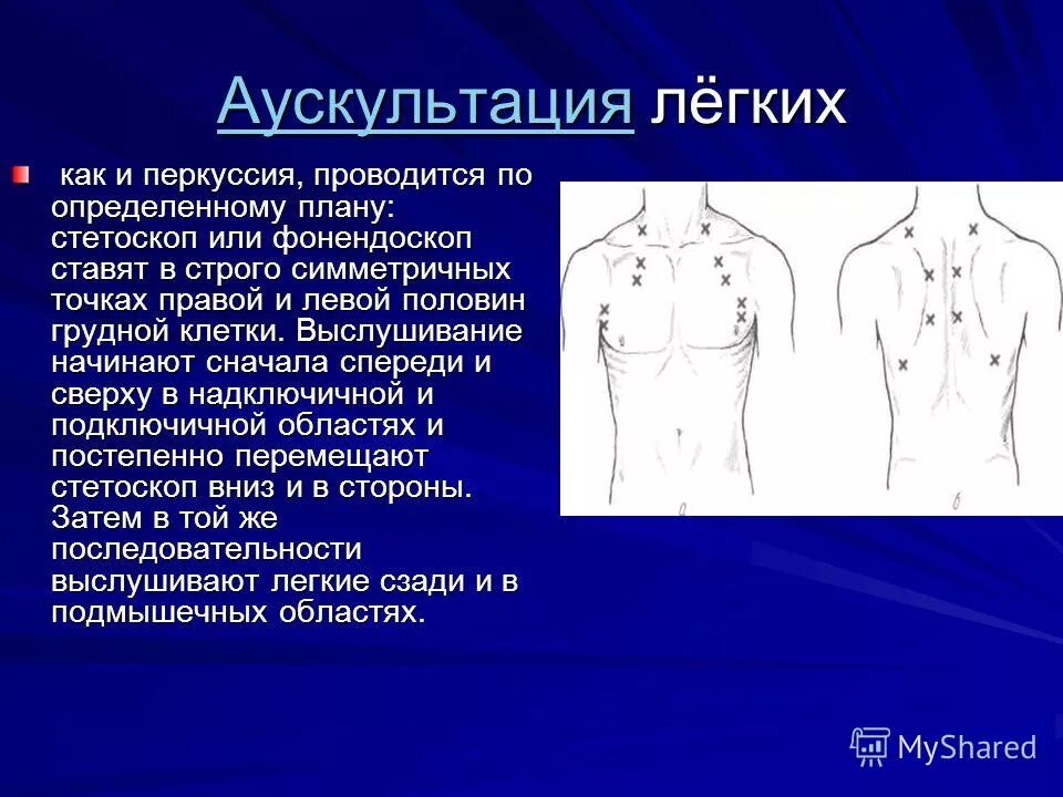 Аускультация грудной клетки пропедевтика. Аускультации грудной клетки методика. Аускультация грудной клетки алгоритм. Перкуссия грудной клетки пропедевтика.