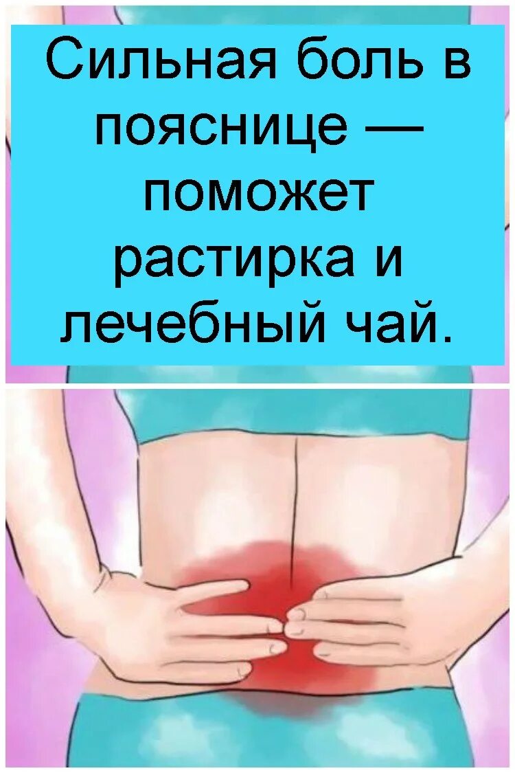 Чем лечить боли в пояснице у женщин. Боль в пояснице. Спинная боль в пояснице. Дорсопатия корешковый синдром. Боль в спине поясница позвоночник.