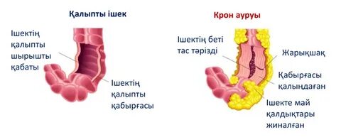 Жыныстық қатынас және ыңғайсыздық