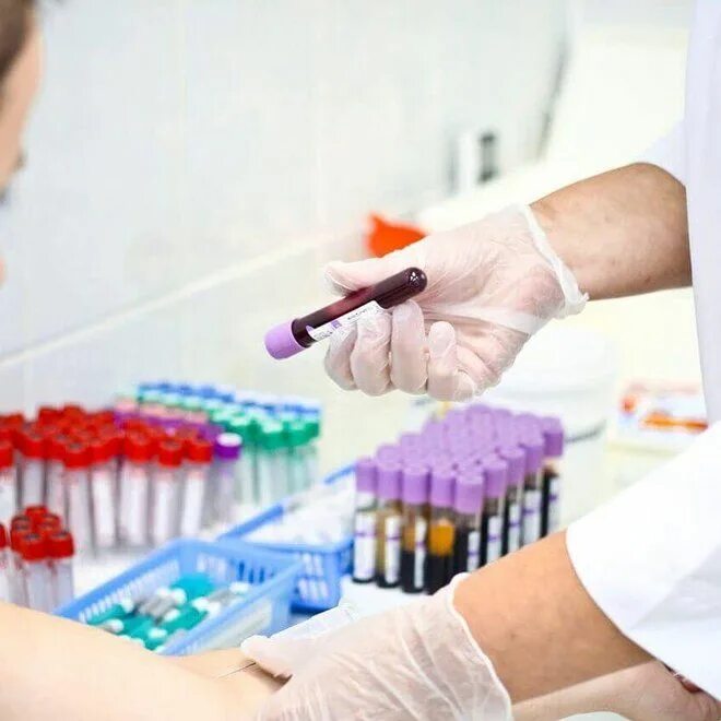 Сайт медицинских анализов. Лабораторные исследования крови. Лаборатория крови. Анализ крови лаборатория. Серологические исследования.
