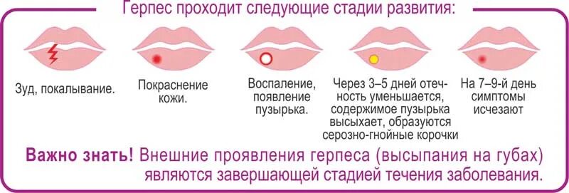 От простуды на губах домашнее: найдено 88 изображений