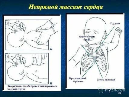 Мест грудной клетки
