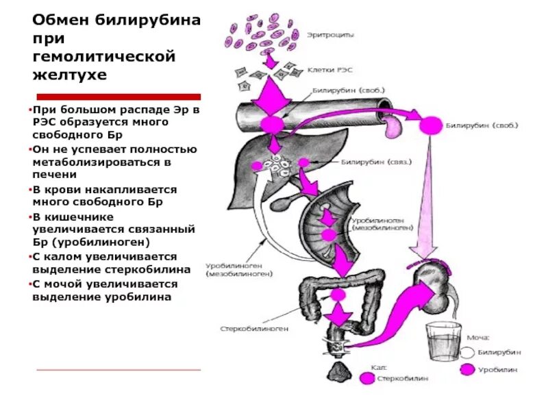 Печеночная желтуха билирубин. Печеночная желтуха билирубин